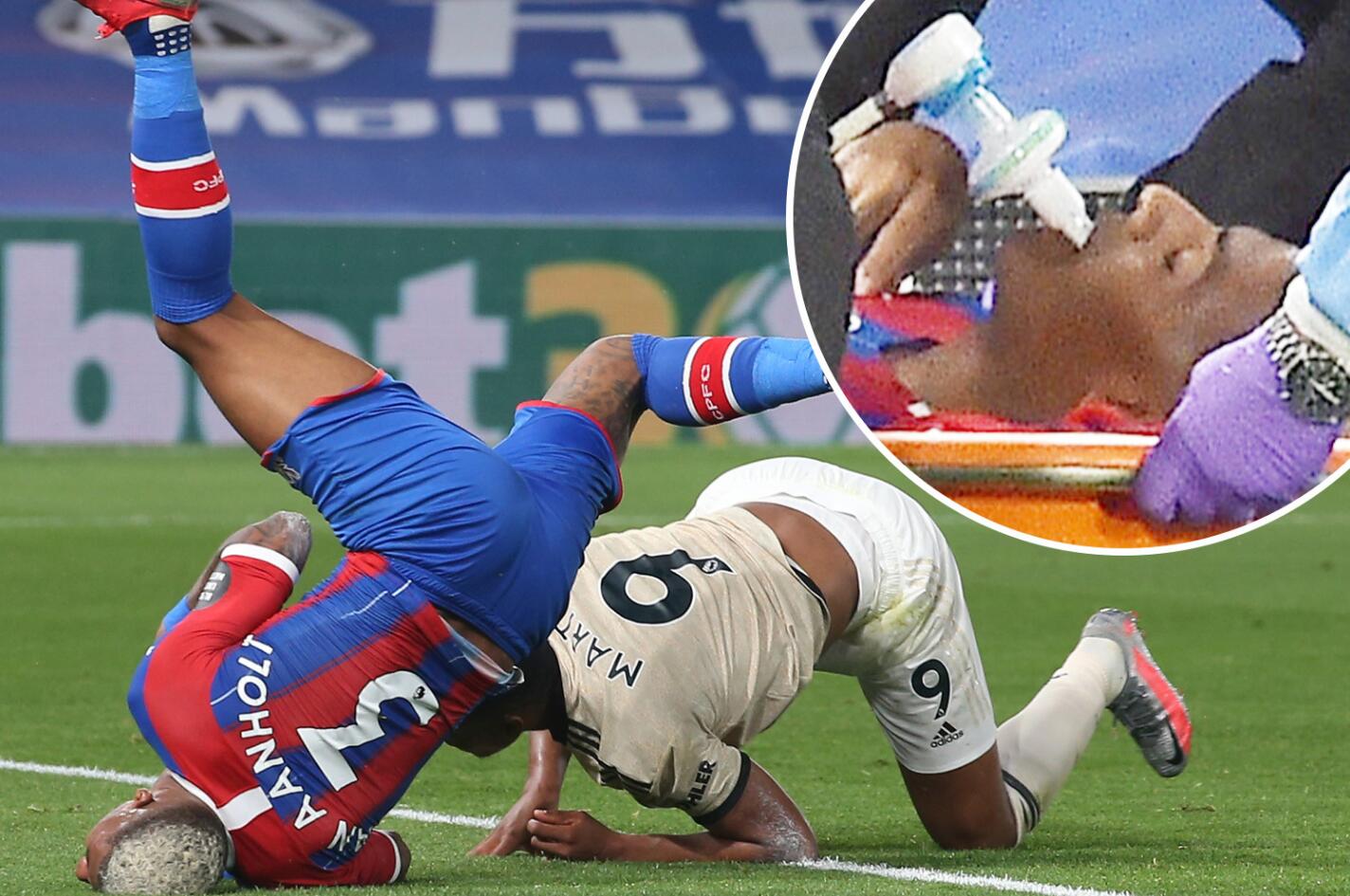 英超|曼联妖王已成2020年英超头号射手！对手为防他肩膀脱臼，重伤吸氧