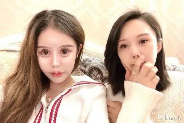 『整容』13岁女孩整容“上瘾”，3年整了60多次，如今的五官让人一言难尽