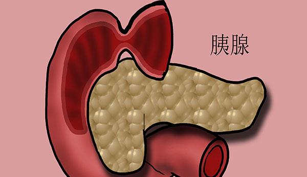 隔离@为什么说胰腺癌是“癌症之王”?4个“警报信号”要重视,别大意