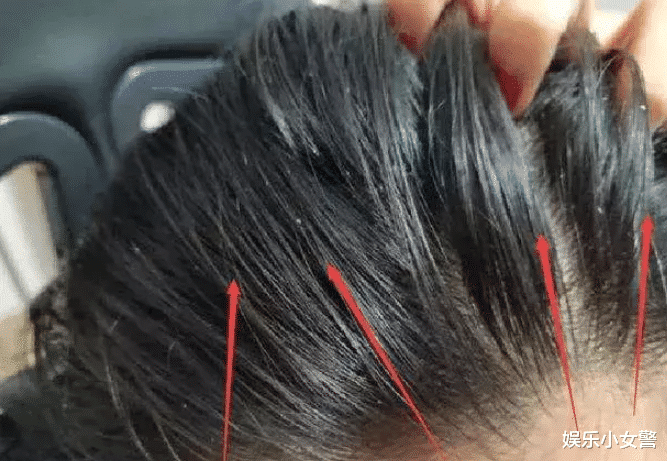 秃头|被拉入“黑名单”的洗发水，学生党却十分偏爱，难怪变成“秃头”小宝贝！