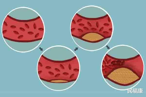 香蕉■经常吃几块钱一瓶的维C,和吃几百一瓶的,效果有什么差别吗?
