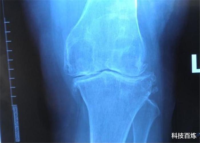 『科学家』曾经消失的器官现在又重新出现，人类是退化还是进化？