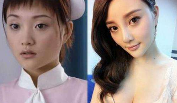 整容|“整容最成功”的4位女星，明明动过多少刀子，却看不出任何痕迹