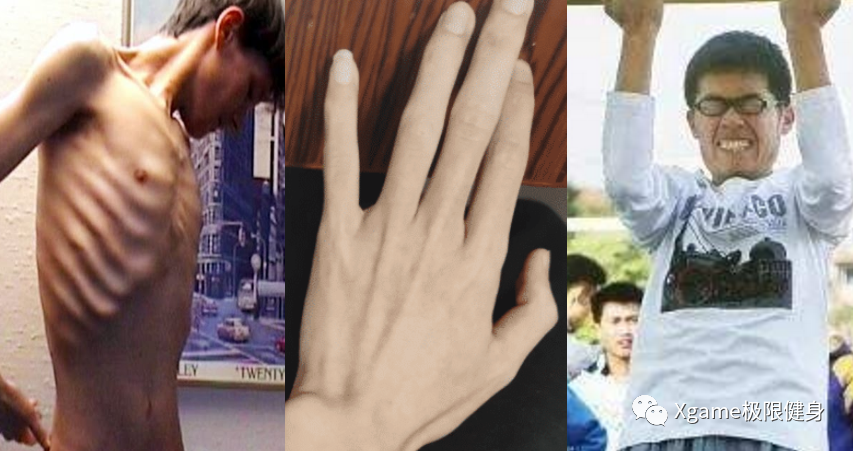 「肝脏」当代男孩子的身体，到底能有多差？