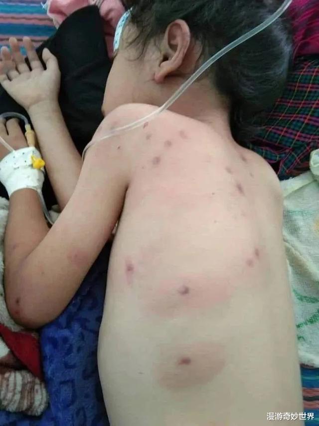 美国@疫情还没结束，杀人蜂又入侵美国，或将成为新的灾难！