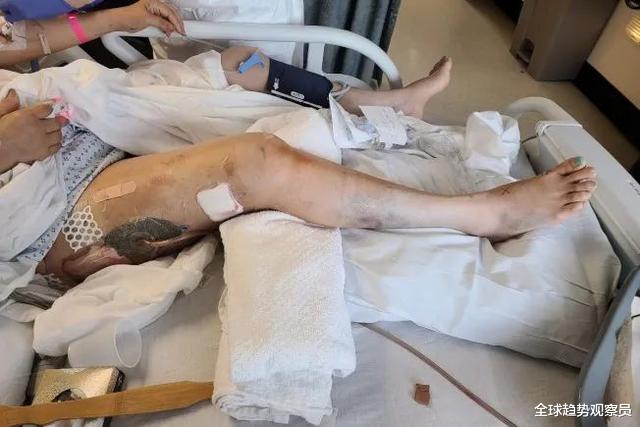 「移民」华人一家暴乱中遭洗劫 弃财逃命仍被打进ICU! 移民半生 一夜心冷