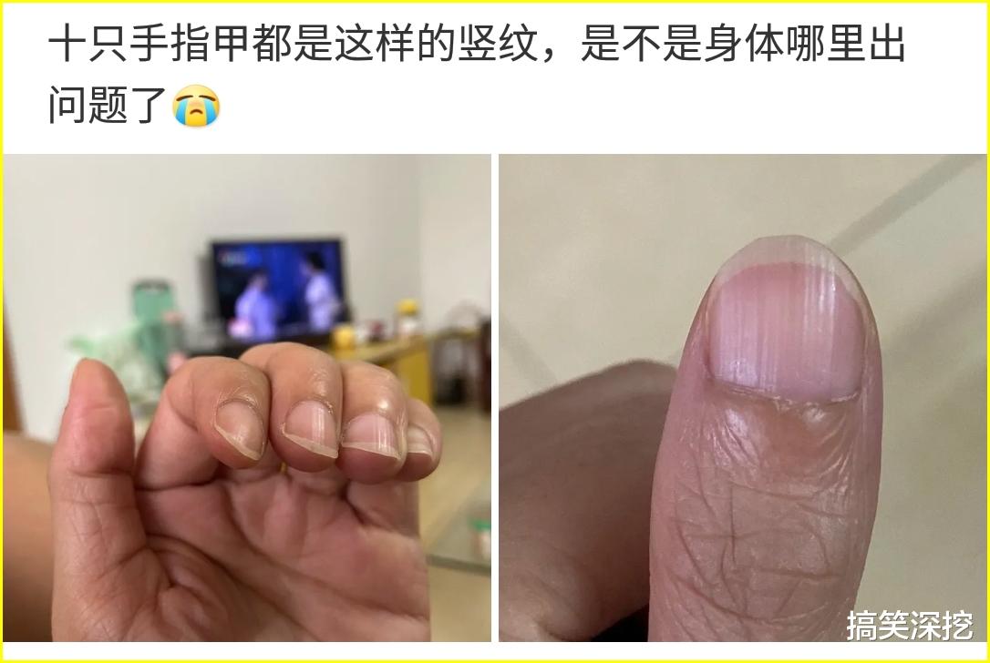 「」“十个手指甲都是这样的竖纹，是不是哪里出毛病了啊？”哈哈哈...