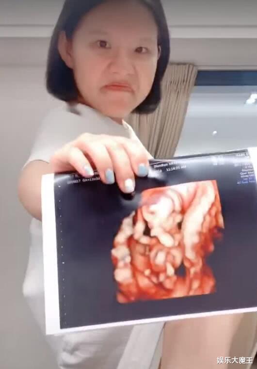 「谢依霖」“Hold住姐”谢依霖宣布生下二胎，与老公宝宝共浴，又经历一次鬼门关