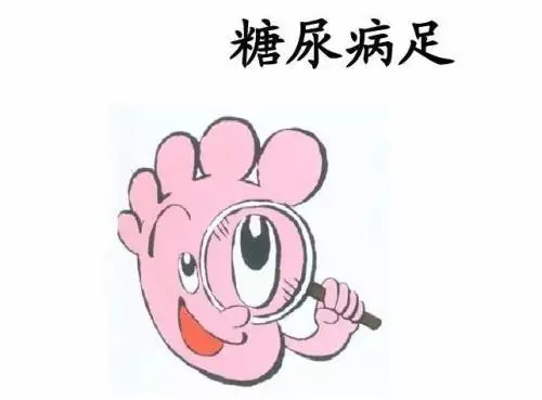 糖尿病足▲糖尿病足的早期症状,早发现、早治疗,才能早点好