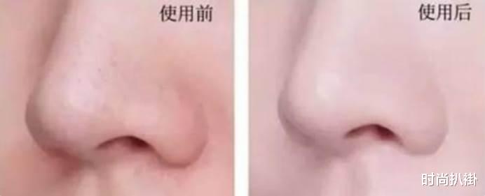 洗面奶 这些被忽略的细节，就是你颜值\上不去\的原因，怪不得皮肤一直不好