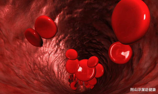 高血脂|大鱼大肉并非高血脂“根源”，这3物才是，劝你莫贪吃！