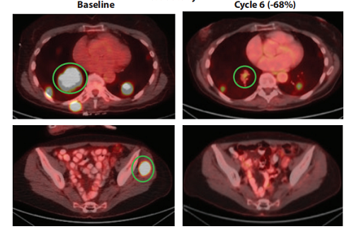 欧洲|又刷屏！新药物针对ALK/ROS1/NTRK多种突变癌症有效