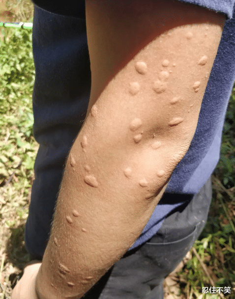 饵料|“奶奶假牙不见了，笑的很开心的狗子有点不对劲”哈哈哈你奶奶在这呢