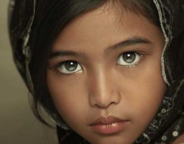 科学家|人可能有三只眼睛吗？印度小女孩的第三只眼，连科学家也无法解释