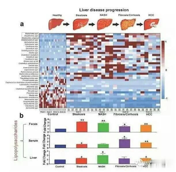 #肝癌#肠道菌群紊乱产生的内毒素是肝癌发生的推手