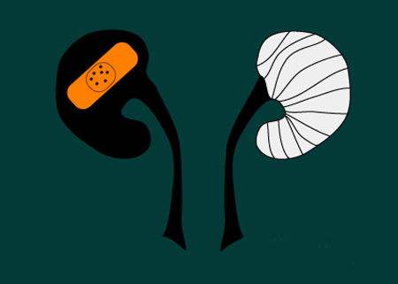 「肾衰竭」肾衰竭并非毫无预兆,身体一旦有这些表现,还请及时就诊!