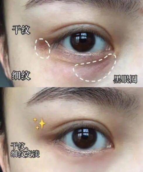 「眼霜」戚薇晒出“万能”眼霜,吴昕:用3年了,李佳琦:眼霜界爱马仕