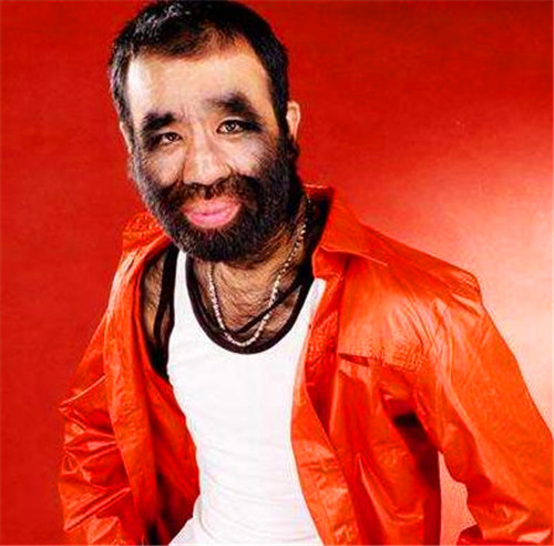 「于震寰」?曾火遍全国的“毛孩”于震寰，43年过去了，如今过得怎样？