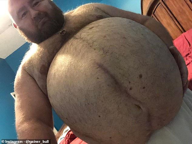 睹图|男子为变美暴饮暴食20年，现体重454斤肚子大的像怀了多胞胎