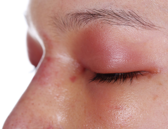 肝脏|肝脏变硬，头部先知！提醒：头部有4种“异常”，提示你该检查了