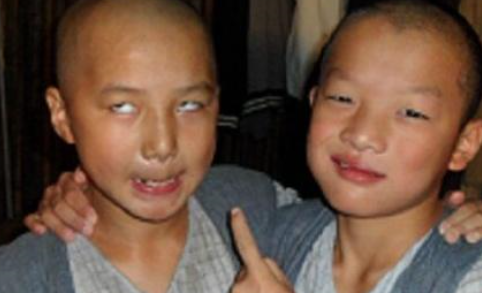 周星驰|亲妈都嫌他丑，13岁却被周星驰一眼看中爆红！20岁长成这样