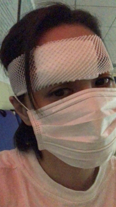 阿娇|阿娇第二次手术重新缝合几百针，任达华介绍顶级整形科医生
