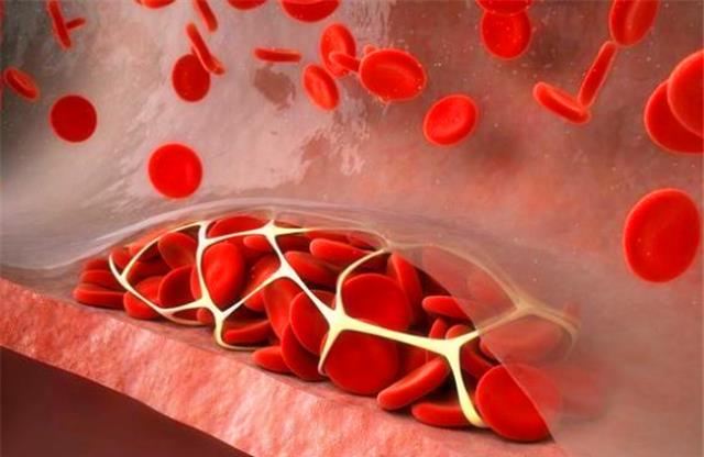 【肠胃】血管堵塞，血液粘稠的人，晚上睡觉的时候，身体会发出哪些信号？