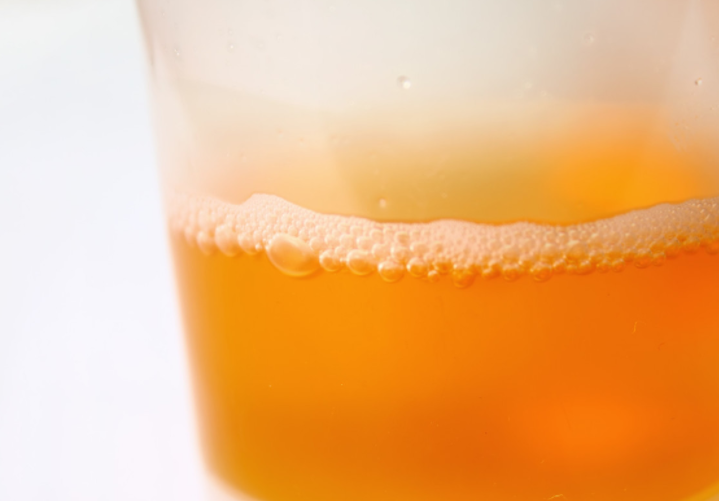 排便@乙肝进入“恶化期”,身体5处都会发“求救”信号,莫忽视!