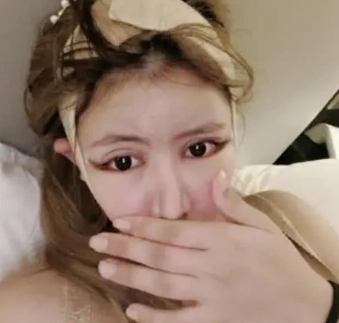 『整容』13岁开始整容，经历60次手术变成“芭比”，女孩：妈妈全程陪同