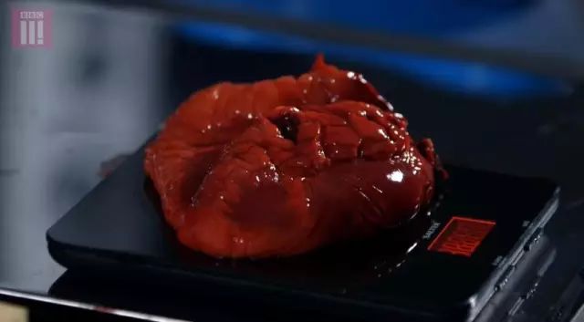 心脏|BBC解剖了一个200斤女子，看完你会用生命去减肥！