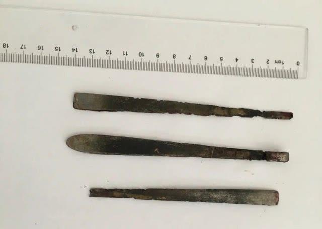 【湖北】郑州男子腹痛难忍，检查发现肠子里有3根近15厘米长金属条，咋回事？