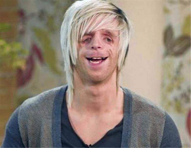 晓君侃史|国外男子脸部畸形，凭才华娶漂亮老婆，孩子出生后两人失去笑容