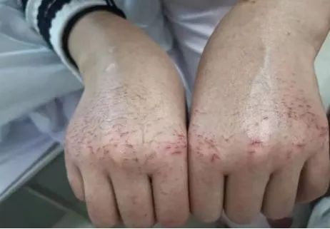 「」“出国避难的明星，打脸14亿国人”，今天，这张照片再次让我们怒不可言