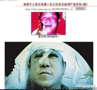 曾志伟|曾志伟被打连缝29针，花100万找凶手，为何一月后容祖儿被约谈？