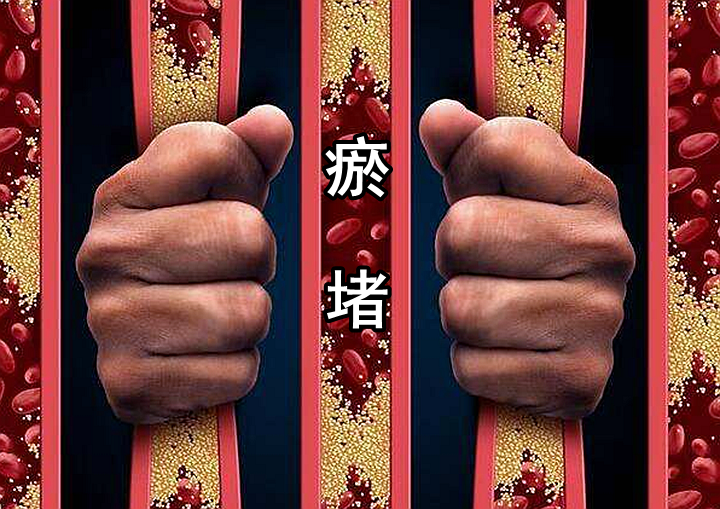 『饮食』身体有没有“瘀堵”，脸上4处一看便知，希望你1个也没占！