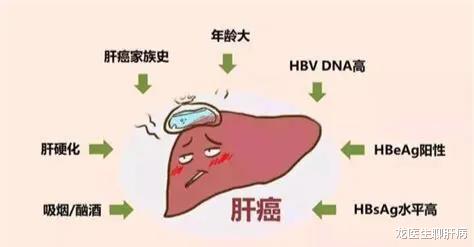 肺癌|谷丙转氨酶高多少，可以判定为肝癌？听听医生怎么说