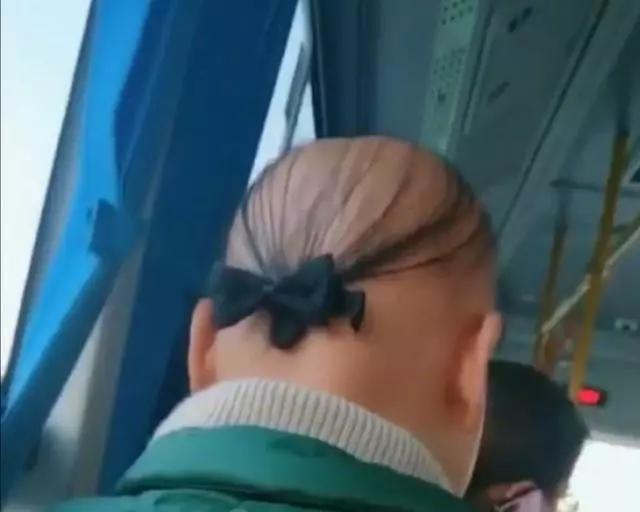 健身|20岁小伙健身半年竟然“秃”了，头发大把大把掉落，你还敢撸铁吗？