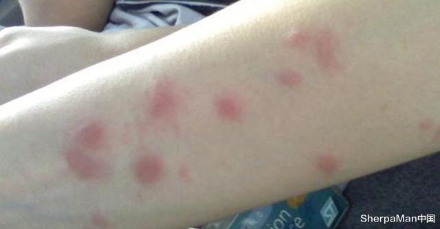 蚊子|小米有品上架驱蚊金钟罩，5分钟蚊子全投降，怕蚊人士：早备上了