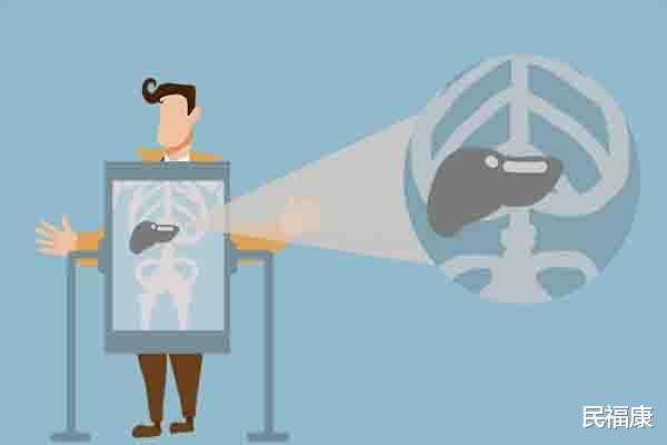 乙肝：都是乙肝患者，为何有人需要治疗，而有些人不需要治？