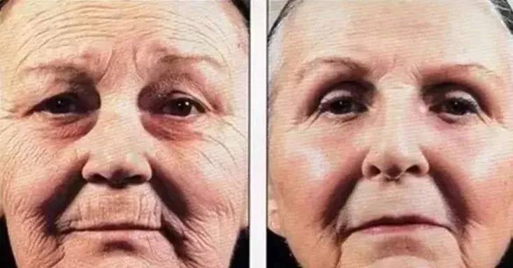 「防晒」防晒不到位，护肤全白费！