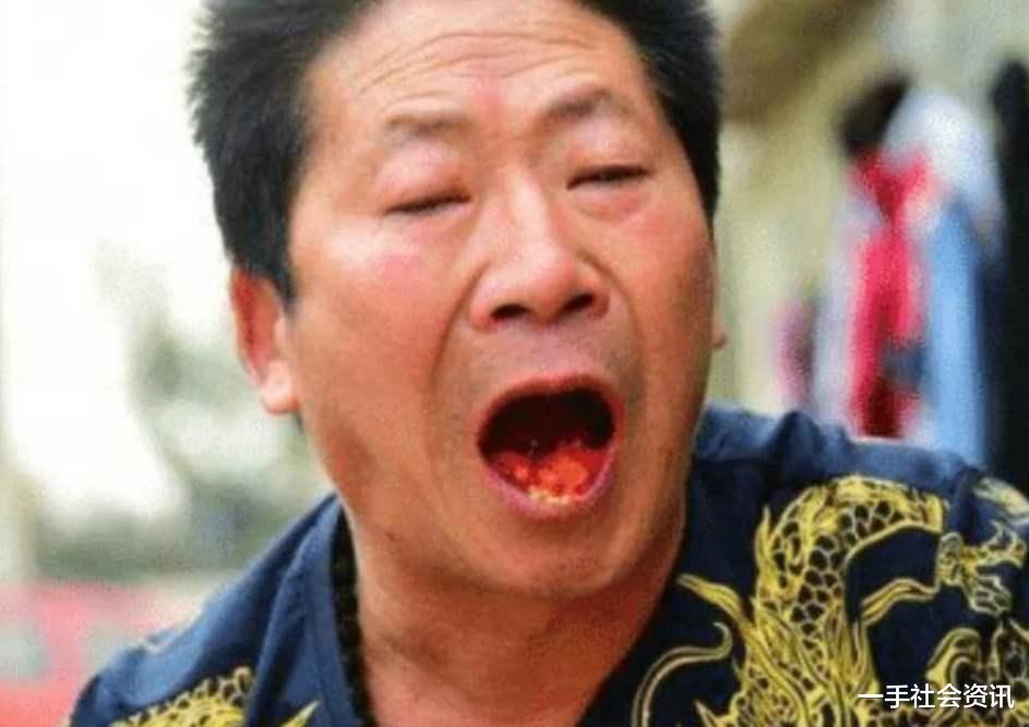 []男子每天吃“5斤”辣椒，被称为“辣王”，如今却成了这样
