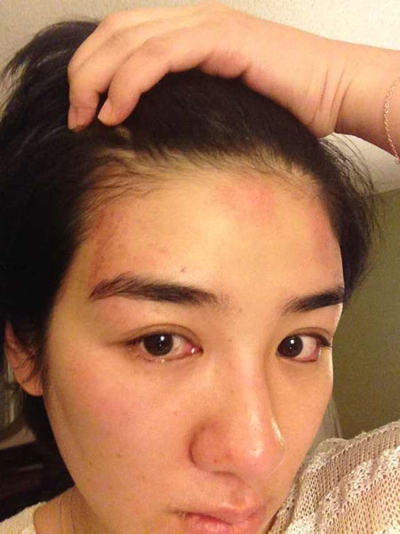 【黄奕】5年离婚两次，被丈夫打到坐轮椅，从一线沦落到三线的女明星