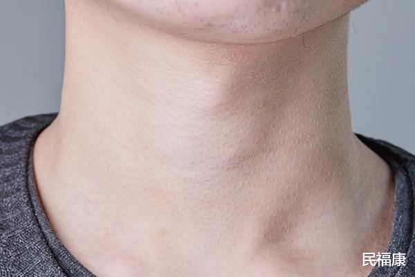 甲状腺结节|提醒:甲状腺有结节的人,3种蔬菜若能撤下餐桌,甲状腺会感谢你