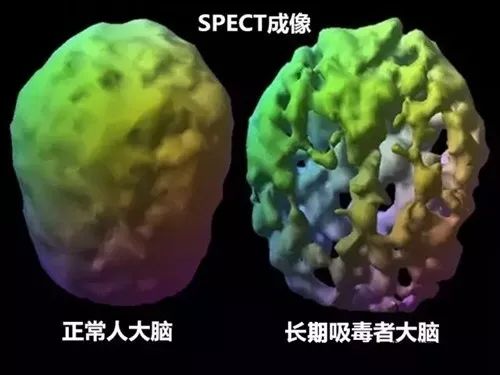 斑鸠@实锤！演员牛萌萌因吸毒被行拘，关于冰毒，你还要知道这些