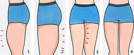 运动|知俏：大腿粗该怎么办？一招教你如何拯救梨形身材！