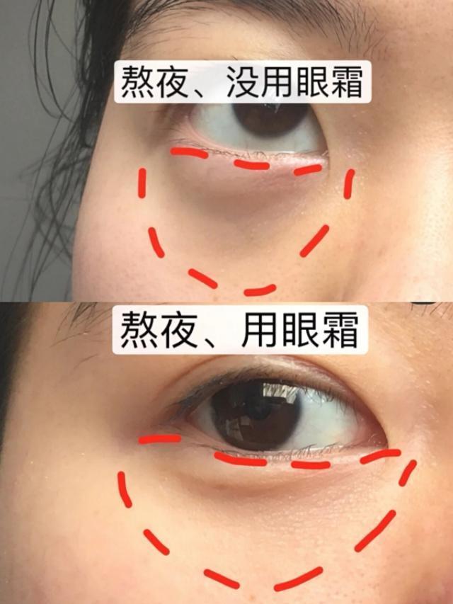 [郭京飞]郭京飞割完眼袋后秒变型男！黑西装造型太有范，对比早前判若两人