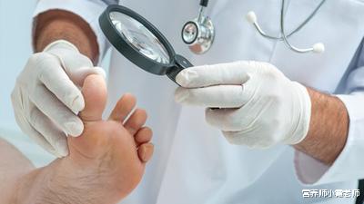 用药指南@提醒糖友:“脚部”出现4种表现,小心并发症,控血糖,做好5件事