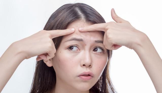 肝脏|36岁女子查出肝硬化晚期，医生坦言：脸部4种异常，早查肝CT