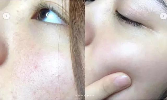 短发 公认最有效的“护肤方法”,不是打美白针!每天1片,安全又有效