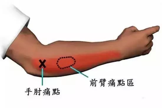 |不开玩笑，继续这样钓鱼，你的手会废掉